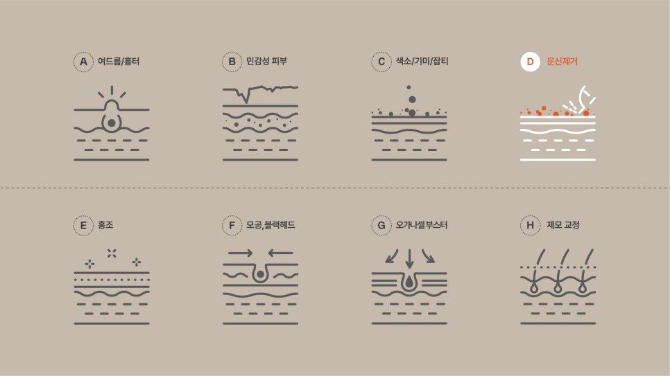 안전하게 문신제거하는 법 관련 이미지 4