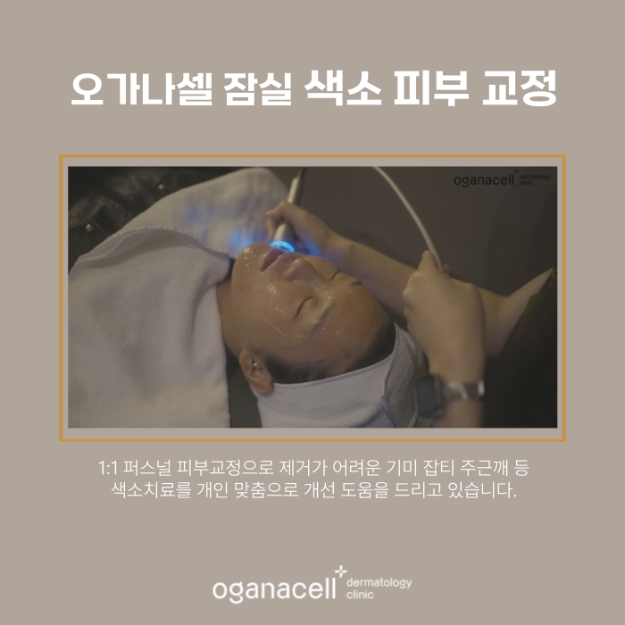 60대 기미 제거 전후 비교 실제사례 관련 이미지 7