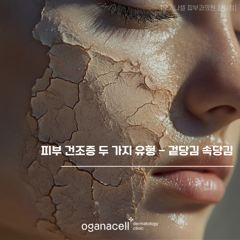피부 건조증 두 가지 유형 겉당김 VS 속당김 관련 이미지 1