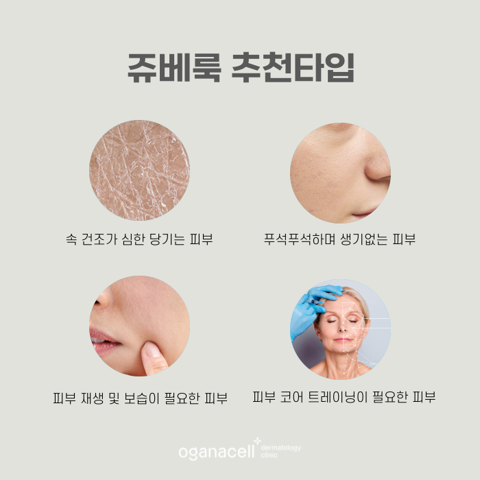 피부부스터 자가 생성하는 방법 쥬베룩(+효과) 관련 이미지 5