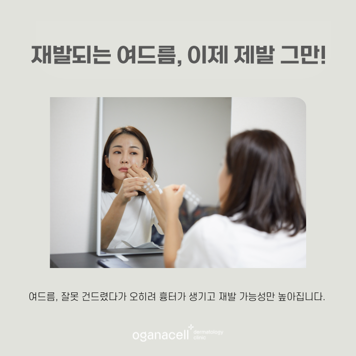 얼굴 트러블 원인 제거해서 해결해 주는 잠실피부과 관련 이미지 6