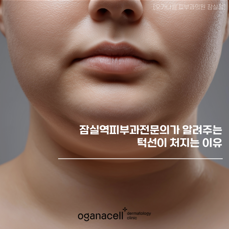 잠실역피부과전문의 가 알려주는 턱선이 처지는 이유 관련 이미지 1