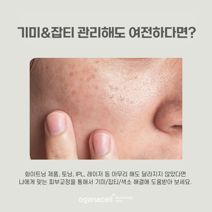잠실역 피부과 임신출산 후 기미관리 관련 이미지 4