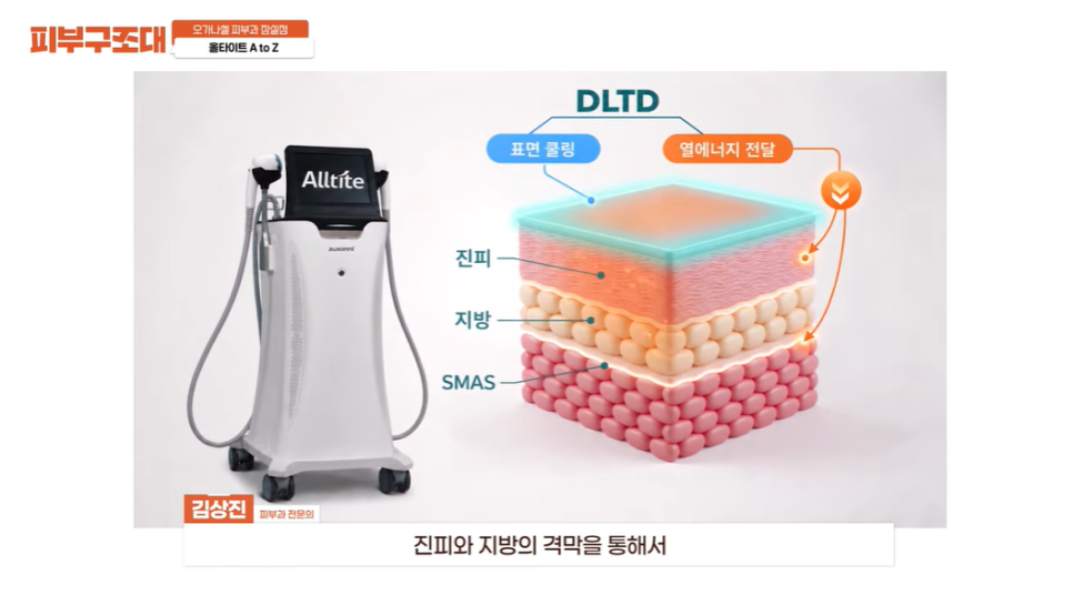 잠실 올타이트 리프팅, 이런 얼굴도 괜찮을까요? 관련 이미지 5