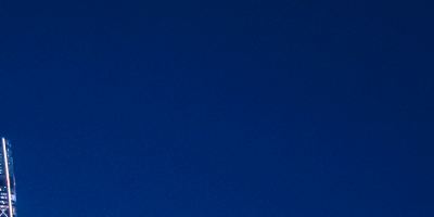 이마 주름, 나이보다 습관에서 찾는 원인들 관련 이미지 12