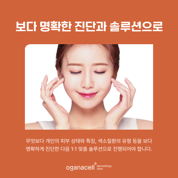 난치성 색소 주의사항 알아야 하는 이유 관련 이미지 5