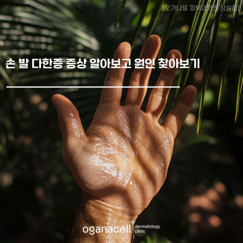 손 발 다한증 증상 및 원인 관련 이미지 1