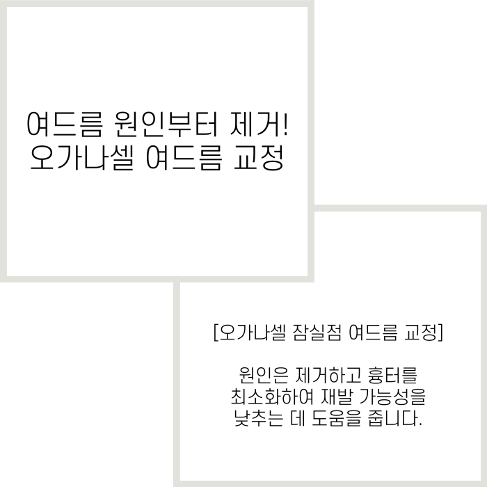 여드름제거 방법 원인부터 없애는 게 좋아요 관련 이미지 2