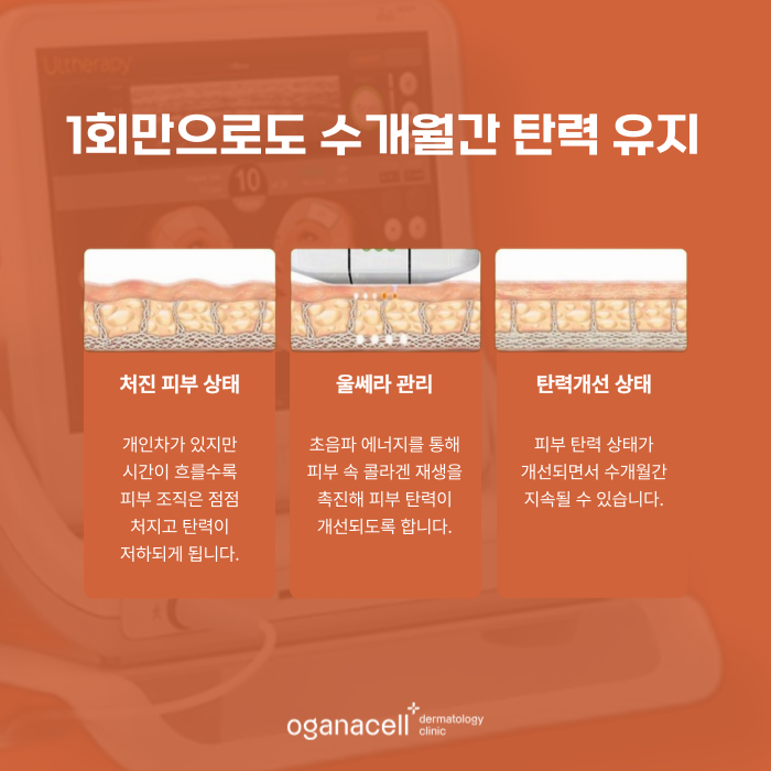 잠실 울쎄라 400샷 600샷 고민될 때 관련 이미지 6