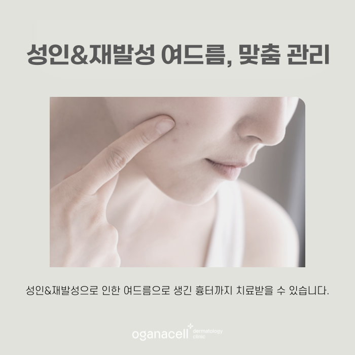 사춘기성 등 여드름압출잘하는곳 잠실피부과 관련 이미지 7