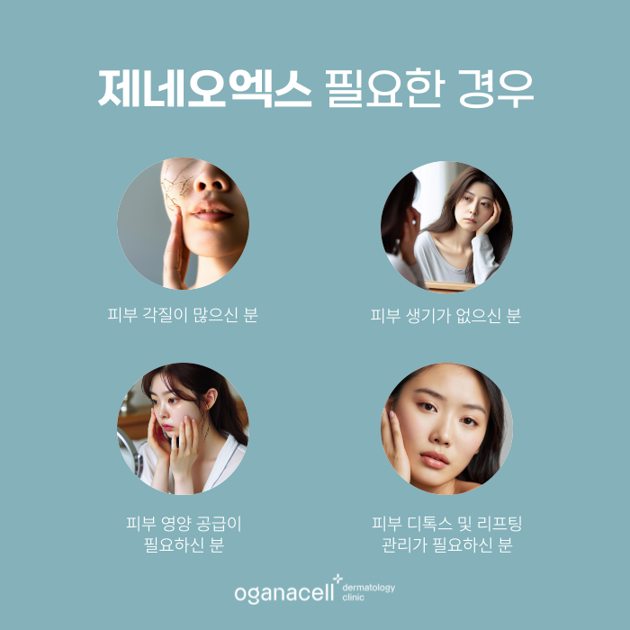 잠실 제네오엑스 3단계 피부 관리 방법 관련 이미지 3