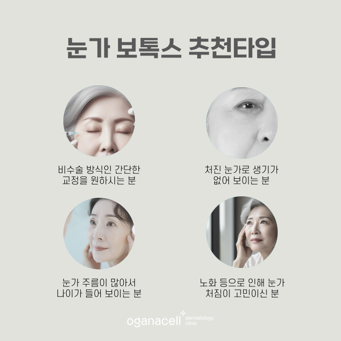 눈가 보톡스 복합적인 교정이 필요할 때 관련 이미지 3