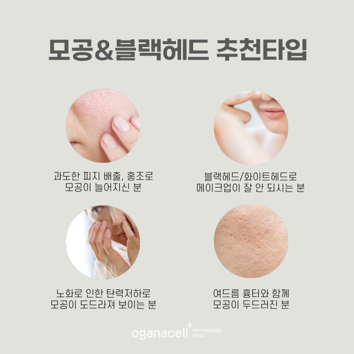 잠실 모공 피부과 잘하는 곳 관련 이미지 3