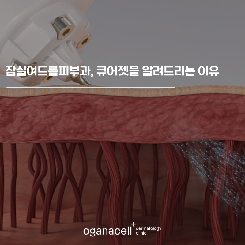 잠실여드름피부과, 큐어젯을 알려드리는 이유 관련 이미지 1