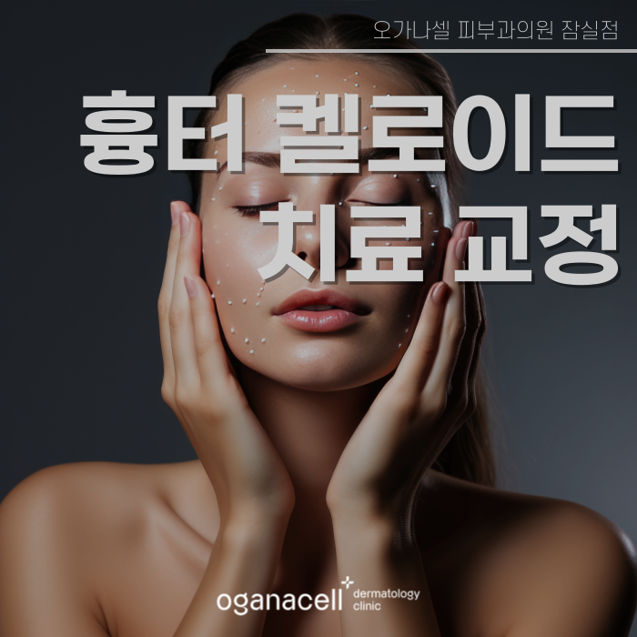 튀어나온 흉터 켈로이드 특징과 치료 시기 관련 이미지 1