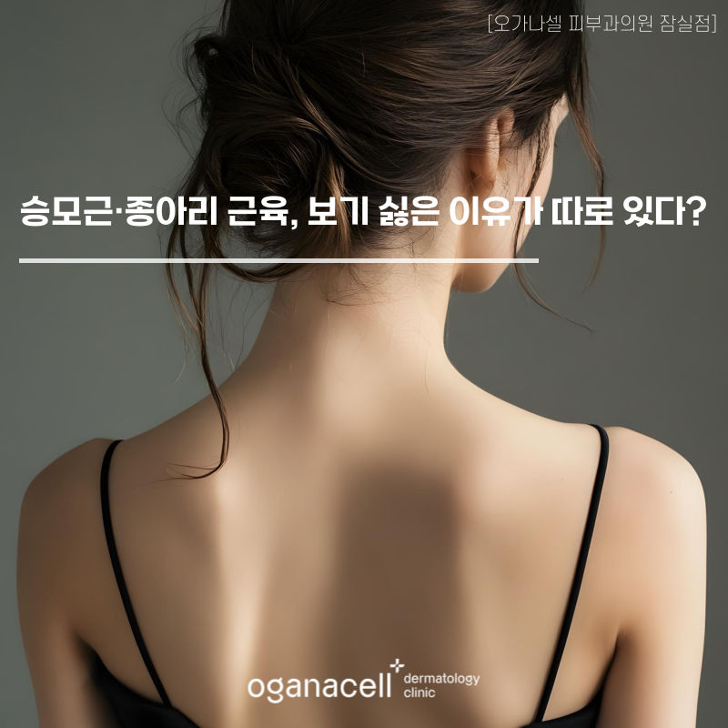 승모근 종아리 근육, 보기 싫은 이유가 따로 있다? 관련 이미지 1