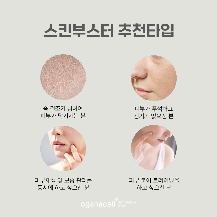 피부장벽 회복 도움주는 스킨부스터 관리 관련 이미지 3