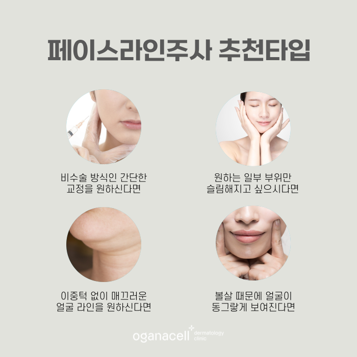 잠실윤곽주사 갸름해지는 비밀 관련 이미지 3