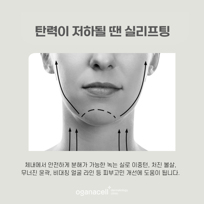 잠실 실리프팅 턱선 끌어올리는 빠른 방법 관련 이미지 5