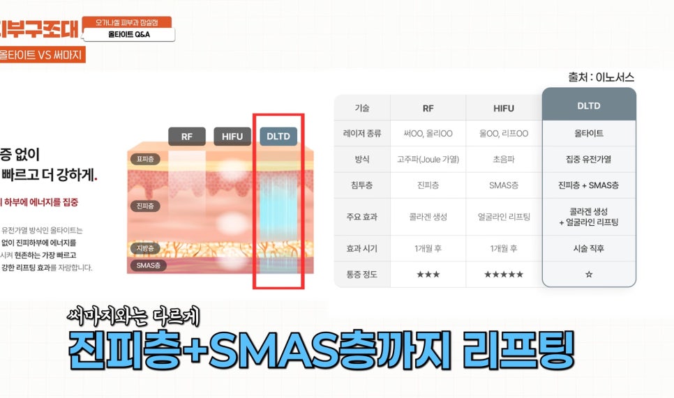 Comparing AllTight and Thermage at a Dermatology Clinic Near Jamsil Saenae Station image 3