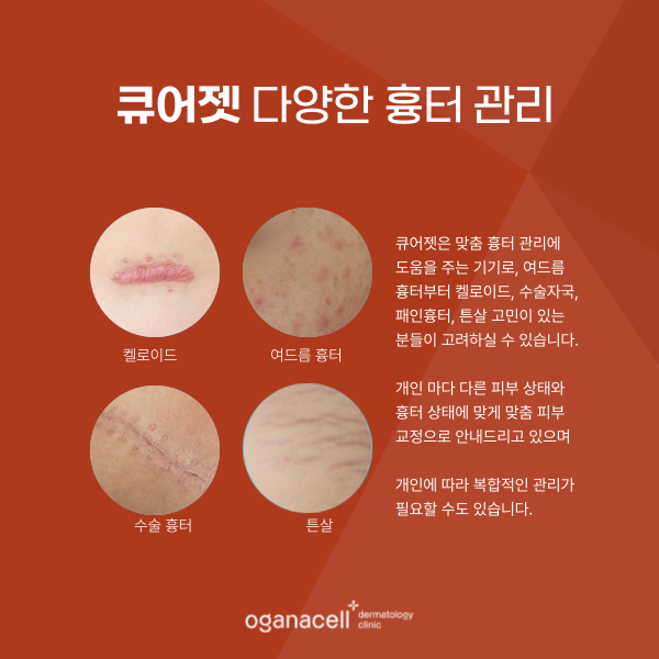 이마여드름흉터 개선 - 잠실피부과 관리법 관련 이미지 5