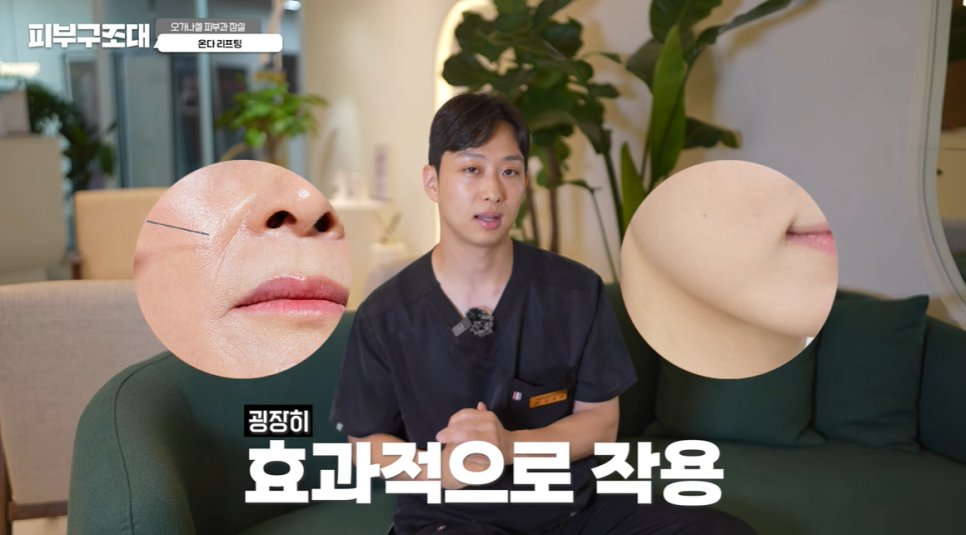 온다리프팅 가격 효과 주기 부작용 총 정리(영상) 관련 이미지 9