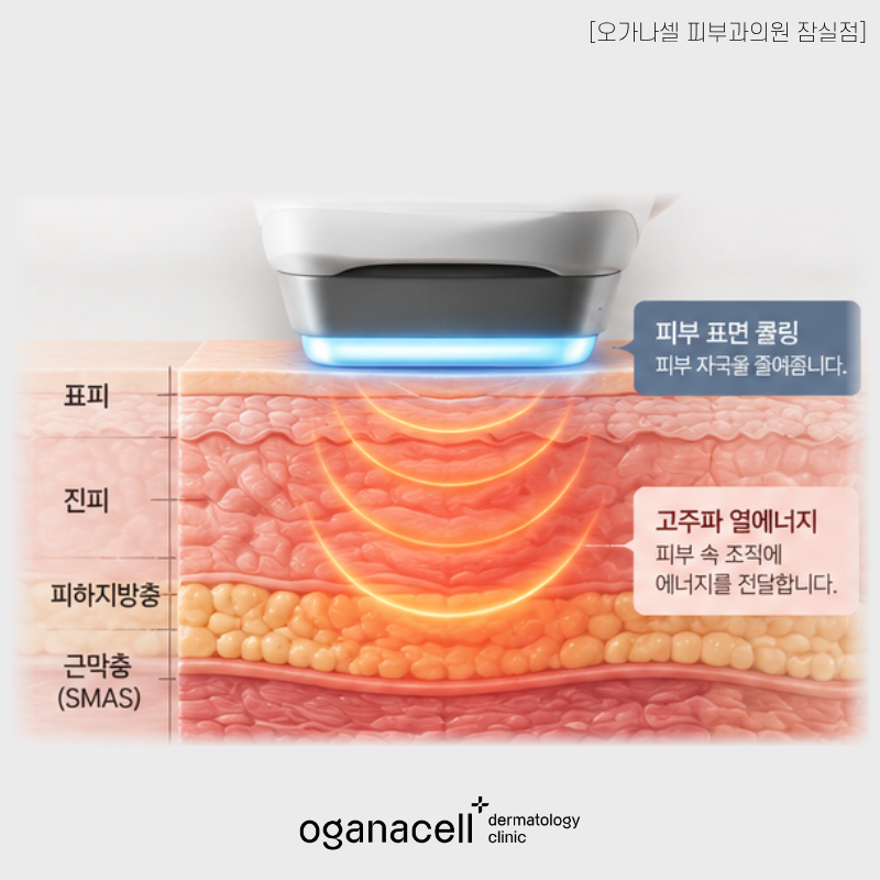 잠실 송파 올타이트, 모두에게 답은 아닙니다 관련 이미지 6