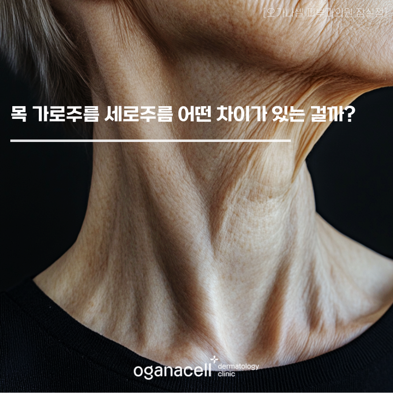 목 가로주름 세로주름 어떤 차이가 있는 걸까? 관련 이미지 1