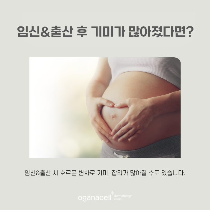 잠실역 피부과 임신출산 후 기미관리 관련 이미지 5
