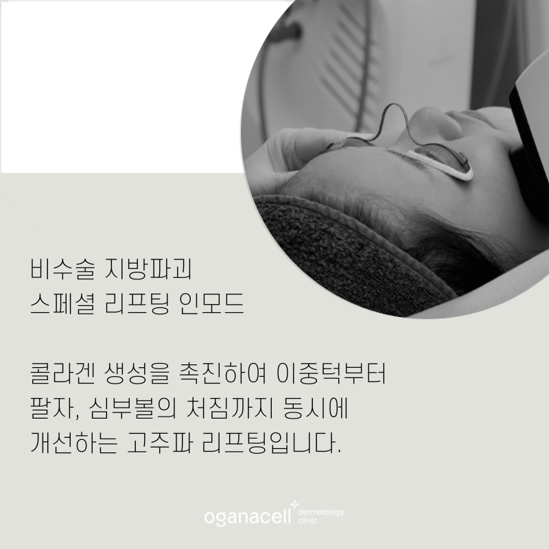 인모드 장점 및 주의할 점 5가지 관련 이미지 10