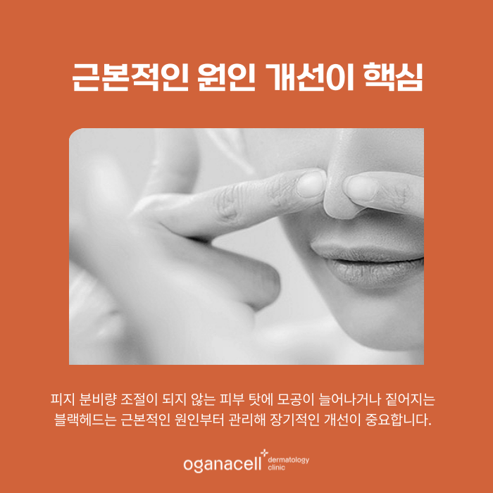 곰보피부 모공 축소보다 알아야 할 핵심 관련 이미지 5