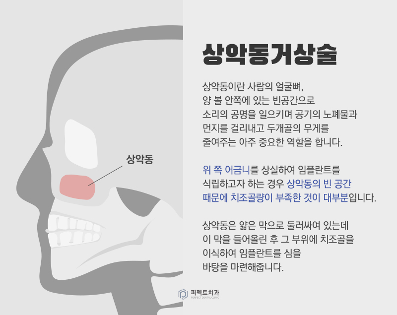 컴퓨터 분석을 통한 임플란트 관련 이미지 10