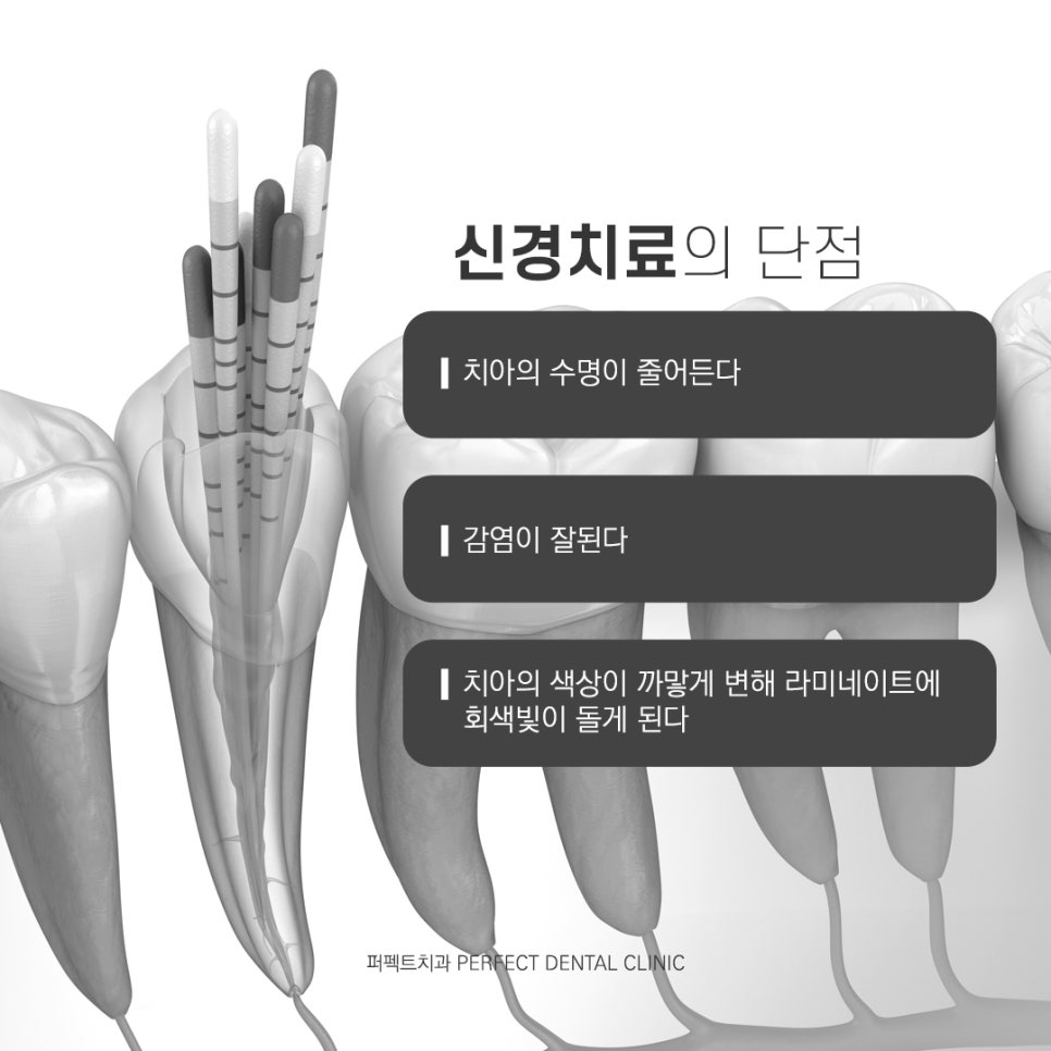 라미네이트 후 부작용은 어떤게 있을까? 관련 이미지 3