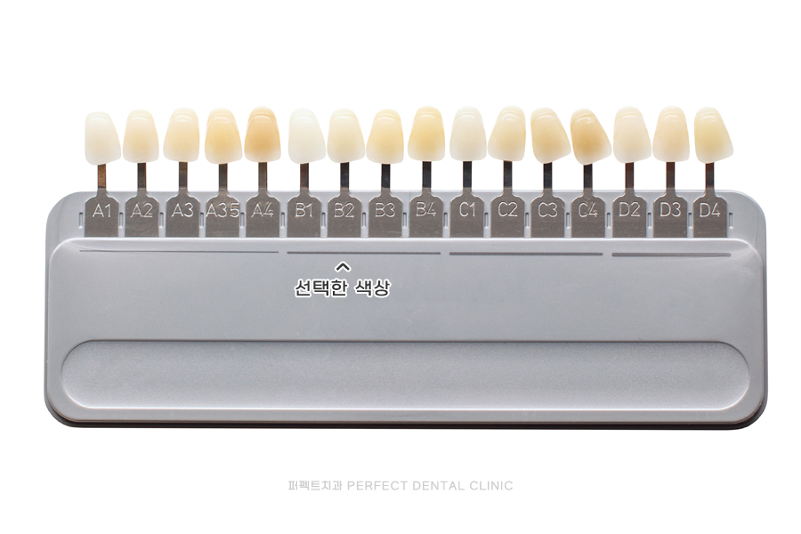 남자 라미네이트, 얼마나 밝게 가능할까? 관련 이미지 3