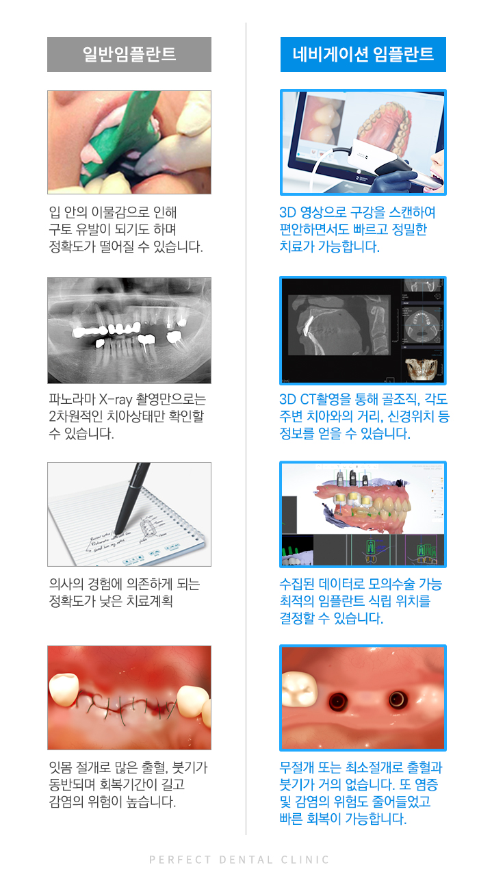 컴퓨터 분석을 통한 임플란트 관련 이미지 7