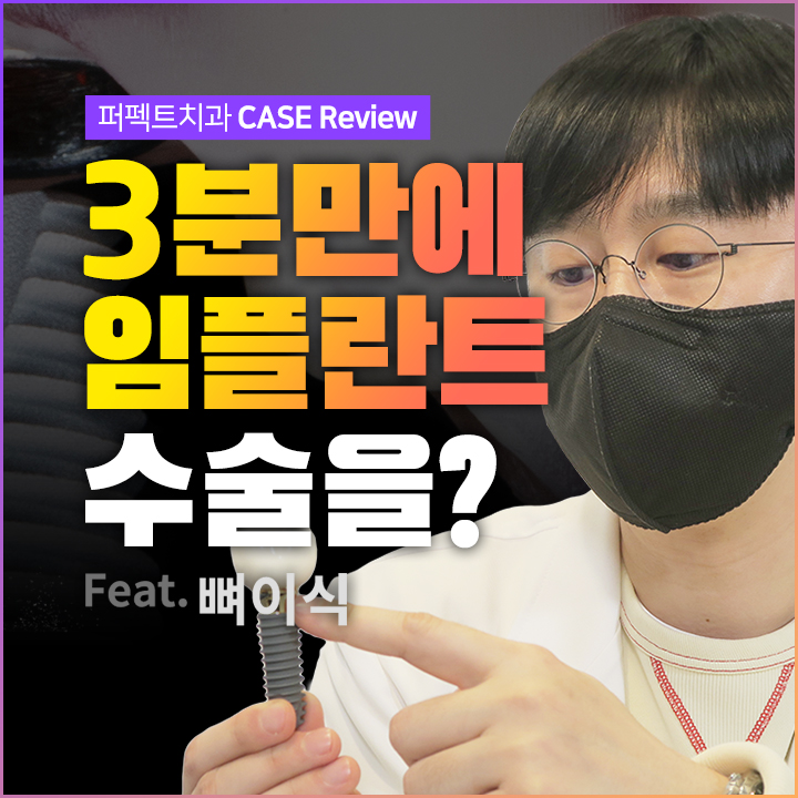3분만에 임플란트를 할 수 있을까? 가이드임플란트 알아보기 관련 이미지 1