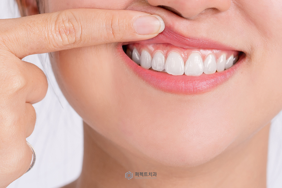 #3 충치치료 후 통증, 혹시 이거 때문에..? 관련 이미지 3