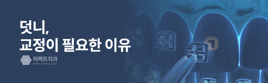 덧니, 교정이 필요하다? 덧니교정의 모든 것! 관련 이미지 3