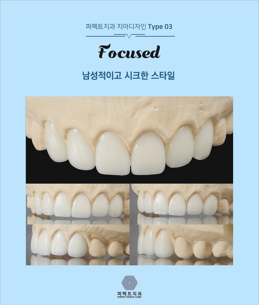 올세라믹 알아보고 있다면! 관련 이미지 7