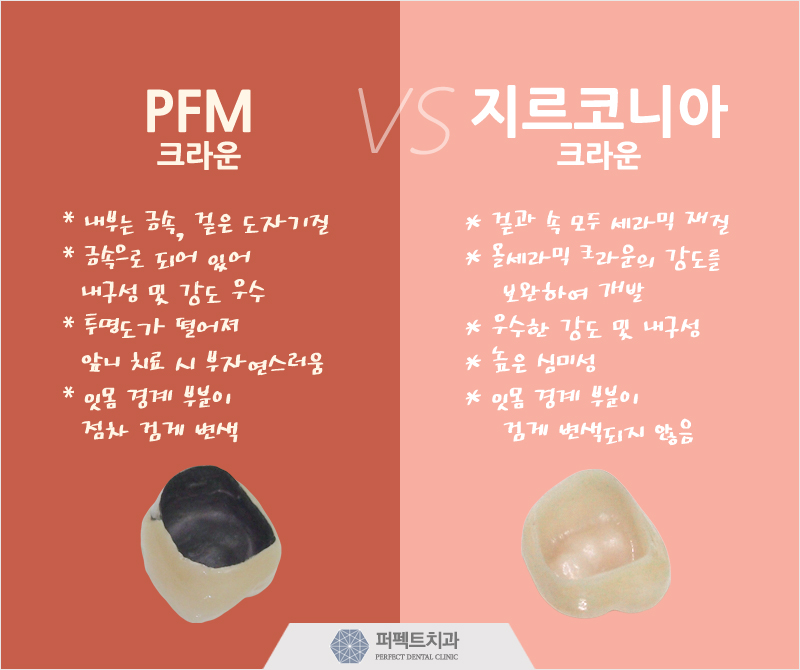 다시돌아온 지르코니아 크라운! 관련 이미지 5