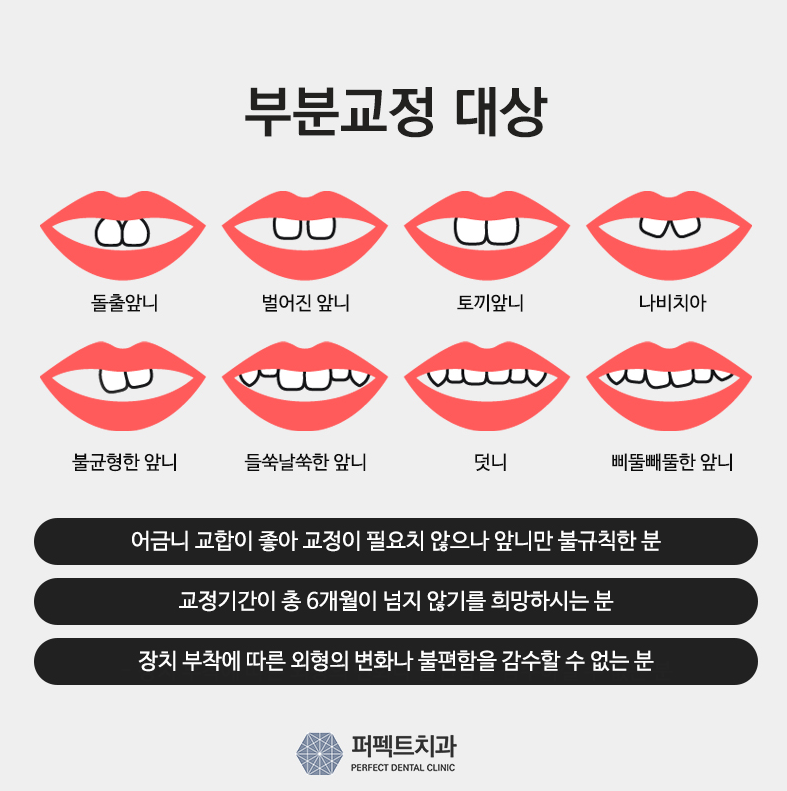 치아단기교정, 과연 얼마나 걸릴까? 관련 이미지 2