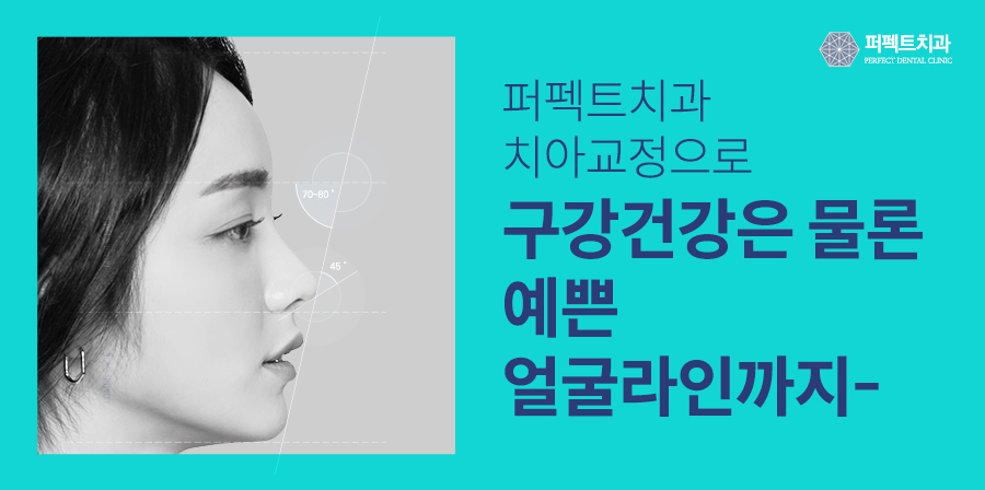 덧니, 교정이 필요하다? 덧니교정의 모든 것! 관련 이미지 6