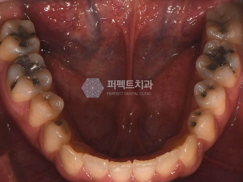 선릉역 치과 추천 확인해보세요! 관련 이미지 3