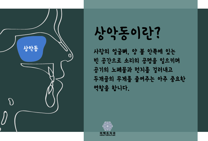 고난도 상악동거상술에 대해 알아보자! 관련 이미지 2