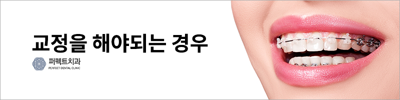 반대교합 비수술 교정 결과는? 관련 이미지 3