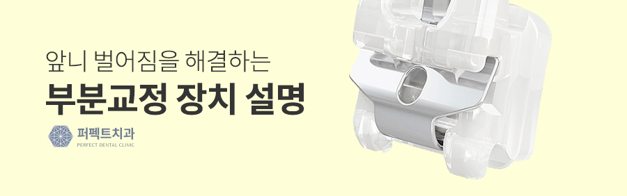 벌어진앞니교정, 원인부터 해결 방법까지 관련 이미지 4