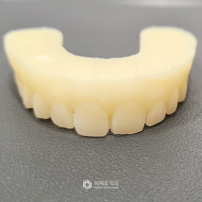 라미네이트 얇을수록 좋은가요? 관련 이미지 2