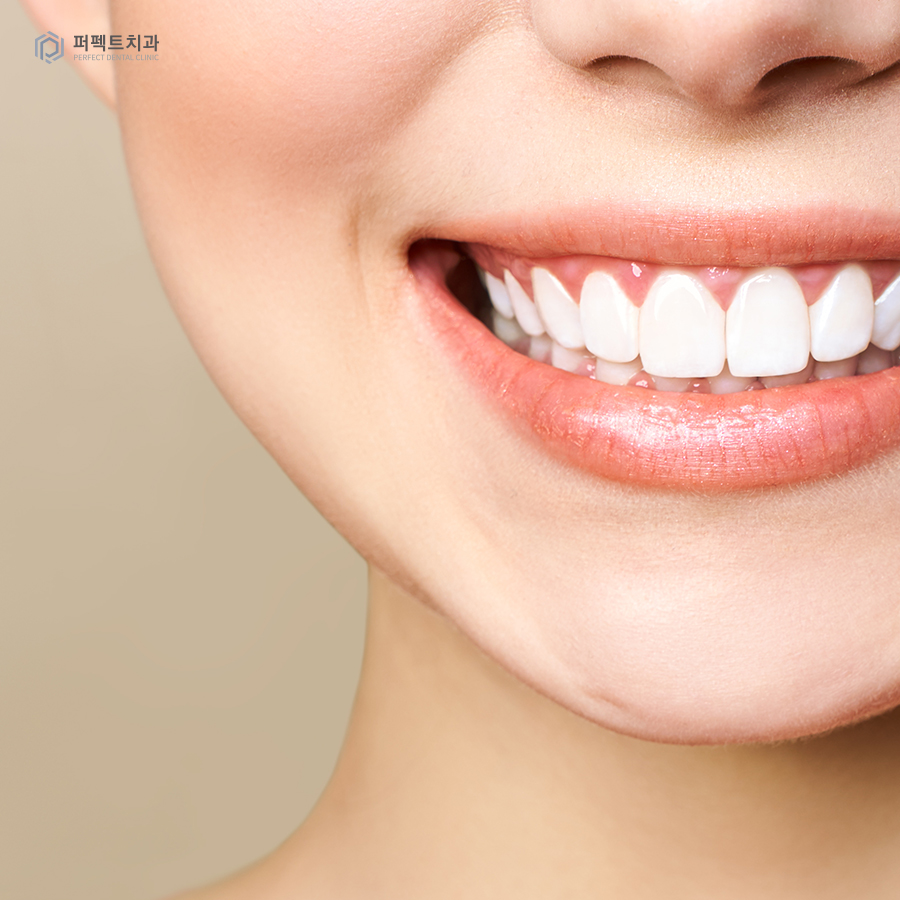 최소삭제, 무삭제 라미네이트가 적합하지 않은 경우는? 관련 이미지 6