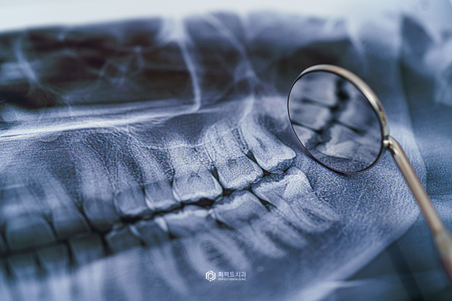 임신 중 치과치료｜치과 엑스레이, 마취약이 걱정돼요! 관련 이미지 1