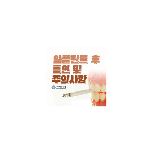 임플란트 흡연, 주의사항 정리임플란트 흡연, 주의사항 정리 관련 이미지 4